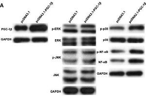 Peroxisome proliferator-activated receptor-gamma coactivator-1 β (PGC-1β) overexpression enhances proinflammatory cytokines, matrix metalloproteinases (MMPs) and receptor activator of nuclear factor-kappa B ligand (RANKL) production in rheumatoid arthritis (RA)-fibrolast-like synoviocytes (FLS). (PPARGC1B anticorps  (AA 901-1023))