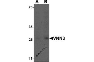 Western Blotting (WB) image for anti-Vanin 3 (VNN3) (C-Term) antibody (ABIN1077383) (VNN3 anticorps  (C-Term))