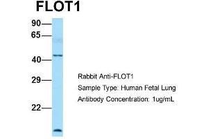 Host: Rabbit  Target Name: FLOT1  Sample Tissue: Human Fetal Lung  Antibody Dilution: 1. (Flotillin 1 anticorps  (C-Term))