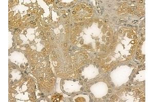 CEP27 Mouse Monoclonal Antibody at 1/100 staining human normal kidney tissue by IHC-P.