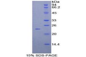 SDS-PAGE (SDS) image for Protocadherin beta 2 (PCDHb2) (AA 79-253) protein (His tag) (ABIN1878857)