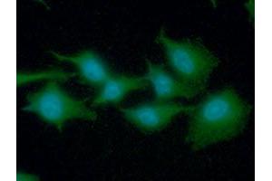 ICC/IF analysis of EEF1A1 in A549 cells line, stained with DAPI (Blue) for nucleus staining and monoclonal anti-human EEF1A1 antibody (1:100) with goat anti-mouse IgG-Alexa fluor 488 conjugate (Green).