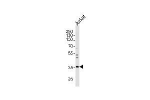 Western blot analysis of lysate from Jurkat cell line, using GLRB Antibody at 1:1000 at each lane. (GLRB anticorps  (N-Term))