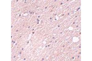 Immunohistochemical staining of human brain tissue with 5 ug/mL FRMPD4 polyclonal antibody . (FRMPD4 anticorps  (Internal Region))