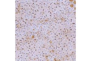 IHC analysis of SNRNP40 using anti-SNRNP40 antibody (ABIN7601719). (SNRNP40 anticorps  (AA 43-357))