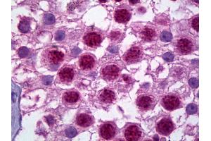 Anti-HES1 antibody IHC of human testis.