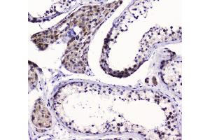 IHC analysis of SMC6L1 using anti-SMC6L1 antibody (ABIN5693133). (SMC6 anticorps  (AA 205-443))