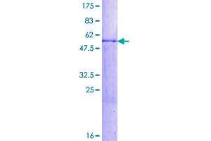 Image no. 1 for Hes Family bHLH Transcription Factor 1 (HES1) (AA 1-277) protein (GST tag) (ABIN1306545)