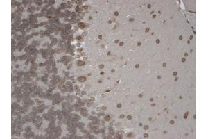 IHC analysis of TrpM7 tested on mouse brain using a dilution of TRPM7 antibody. (TRPM7 anticorps  (AA 1817-1863))