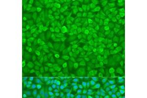 Immunofluorescence analysis of U2OS cells using YTHDF3 Polyclonal Antibody at dilution of 1:100.