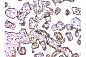 IHC analysis of HDAC5 using anti-HDAC5 antibody (ABIN6719321). (HDAC5 anticorps  (AA 102-197))