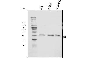 Western blot analysis of SRI using anti-SRI antibody (ABIN7599836).