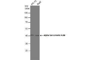 WB Image Various whole cell extracts (30 μg) were separated by 10% SDS-PAGE, and the membrane was blotted with alpha Sarcomeric Actin antibody , diluted at 1:1000. (Actin, gamma 1 anticorps  (N-Term))