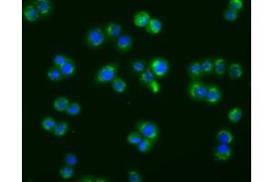 Image no. 7 for anti-Acetyl-CoA Acetyltransferase 2 (ACAT2) antibody (ABIN1496402) (ACAT2 anticorps)