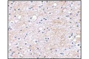 Immunohistochemical staining of human brain tissue using AP30496PU-N at 2. (LGI1 anticorps  (Center))