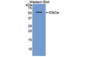 Western Blotting (WB) image for anti-Proteasome (Prosome, Macropain) 26S Subunit, ATPase, 2 (PSMC2) (AA 1-433) antibody (ABIN1860335)