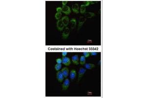 ICC/IF Image Immunofluorescence analysis of methanol-fixed A431, using Tyrosyl tRNA synthetase, antibody at 1:200 dilution.