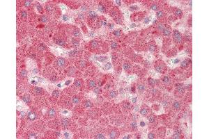 Human Liver: Formalin-Fixed, Paraffin-Embedded (FFPE)