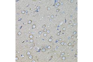 Immunohistochemistry of paraffin-embedded rat brain using SPP1 antibody (ABIN1874927) at dilution of 1:100 (40x lens).