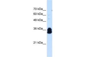 Western Blotting (WB) image for anti-Family with Sequence Similarity 134, Member B (FAM134B) antibody (ABIN2463987)