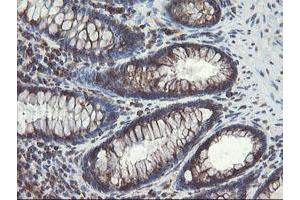 Image no. 2 for anti-Acyl-CoA Binding Domain Containing 3 (Acbd3) antibody (ABIN1498415)