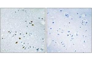 Immunohistochemistry analysis of paraffin-embedded human brain tissue, using BRCA2 Antibody.