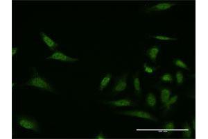 Immunofluorescence of monoclonal antibody to MKNK1 on HeLa cell.
