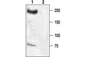 Western blot analysis of rat brain membrane: - 1. (SCN8A anticorps  (Intracellular))