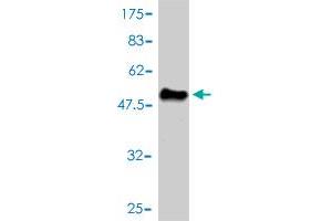 Western Blot detection against Immunogen (48. (Mre11 anticorps  (AA 1-206))