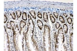 IHC testing of FFPE rat intestine tissue with Musashi antibody at 1ug/ml.