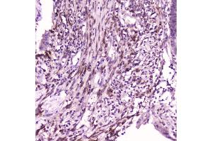 IHC analysis of IL36 alpha using anti-IL36 alpha antibody (ABIN5693268). (IL36A/IL1F6 anticorps  (AA 6-151))