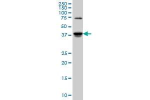 SGK2 monoclonal antibody (M04), clone 4B12 Western Blot analysis of SGK2 expression in PC-12 . (SGK2 anticorps  (AA 293-367))