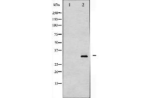 Western blot analysis of DARPP-32 phosphorylation expression in PMA treated NIH-3T3 whole cell lysates,The lane on the left is treated with the antigen-specific peptide.