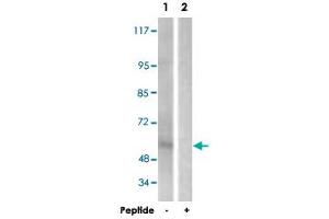 Western blot analysis of extracts from HepG2 cells, using IL2RB polyclonal antibody . (IL2 Receptor beta anticorps)