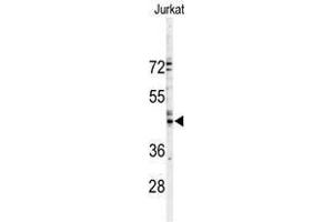 Image no. 1 for anti-Gap Junction Protein, alpha 3, 46kDa (GJA3) (N-Term) antibody (ABIN357087) (GJA3 anticorps  (N-Term))