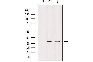 Western blot analysis of extracts from various samples, using RPS4Y1 Antibody. (RPS4Y1 anticorps)