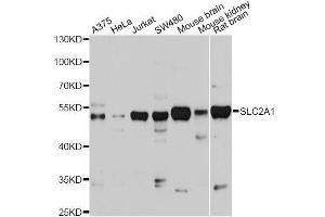 Western blot analysis of extracts of various cell lines, using SLC2A1 antibody. (GLUT1 anticorps  (AA 210-310))