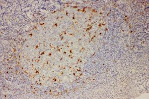 Anti-IL18 Picoband antibody,  IHC(P): Human Tonsil Tissue (IL-18 anticorps  (AA 37-193))