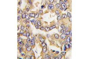 Image no. 3 for anti-Visinin-Like 1 (VSNL1) (C-Term) antibody (ABIN357108)