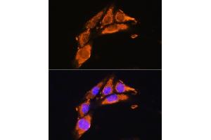 Immunofluorescence analysis of NIH/3T3 cells using AGRN Rabbit pAb (ABIN7265516) at dilution of 1:100.