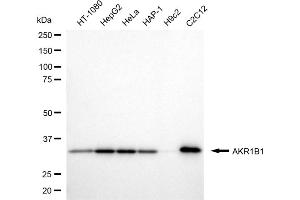 Western blotting analysis using AKR1B1 antibody (ABIN7797570).