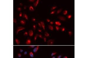Immunofluorescence analysis of U2OS cells using CHRM5 Polyclonal Antibody (CHRM5 anticorps)