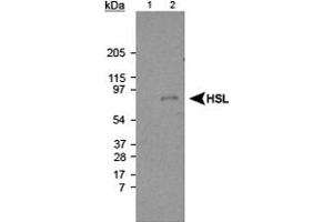 Western blot analysis of Lipe using Lipe polyclonal antibody . (LIPE anticorps  (AA 699-908))