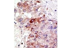 Image no. 2 for anti-Protein Inhibitor of Activated STAT, 1 (PIAS1) (N-Term) antibody (ABIN5552003) (PIAS1 anticorps  (N-Term))