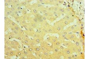 Immunohistochemistry of paraffin-embedded human liver tissue using ABIN7161897 at dilution of 1:100