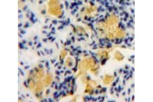 IHC-P analysis of Bowels tissue, with DAB staining. (PKC zeta anticorps  (AA 404-591))
