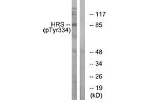 Western blot analysis of extracts from HepG2 cells treated with PMA 125ng/ml 30', using HRS (Phospho-Tyr334) Antibody. (HRS (HRS) (AA 301-350), (pTyr334) anticorps)