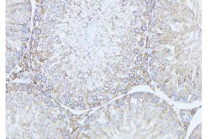 ABIN6279533 at 1/100 staining Mouse testis tissue by IHC-P. (MRAP anticorps  (Internal Region))