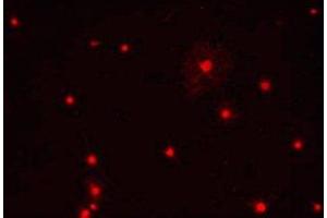 Immunostaining of primary rat oligodendrocytes using anti-Olig1. (OLIG1 anticorps)