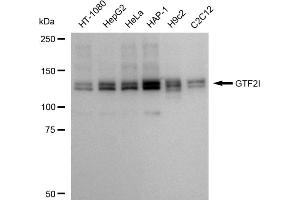 Western blotting analysis using GTF2I antibody (ABIN7798709).